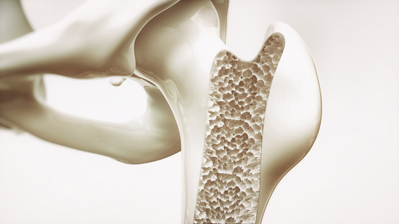 These Top 5 Bone Supplements Can Help Strengthen Bones Better than Calcium Alone